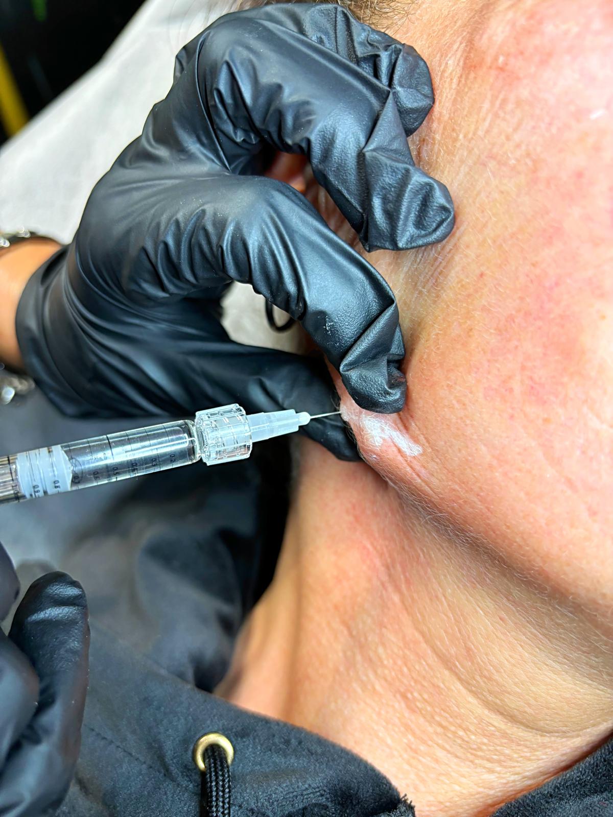  QT Injectables - Advanced Aesthetics-  Enquiries: qtinjectables1@hotmail.com  