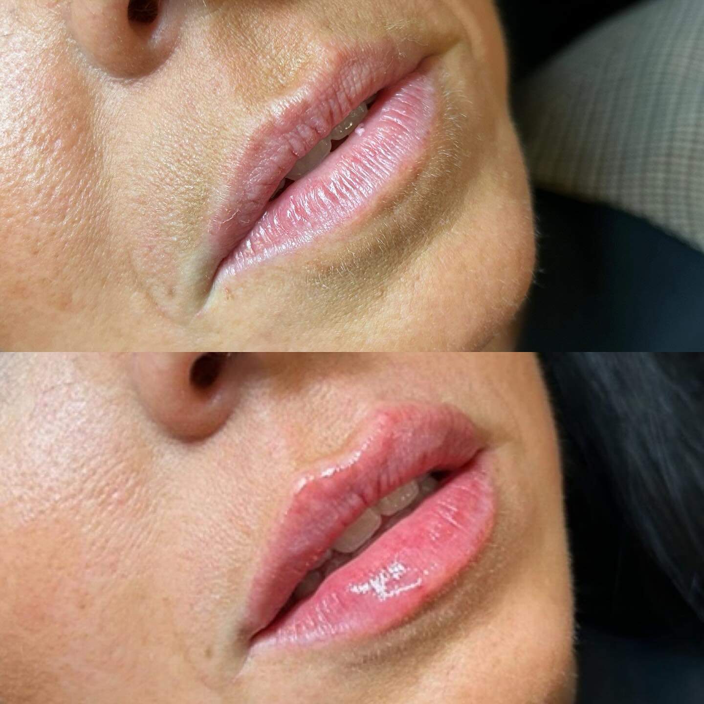  QT Injectables - Advanced Aesthetics -  Enquiries: qtinjectables1@hotmail.com  