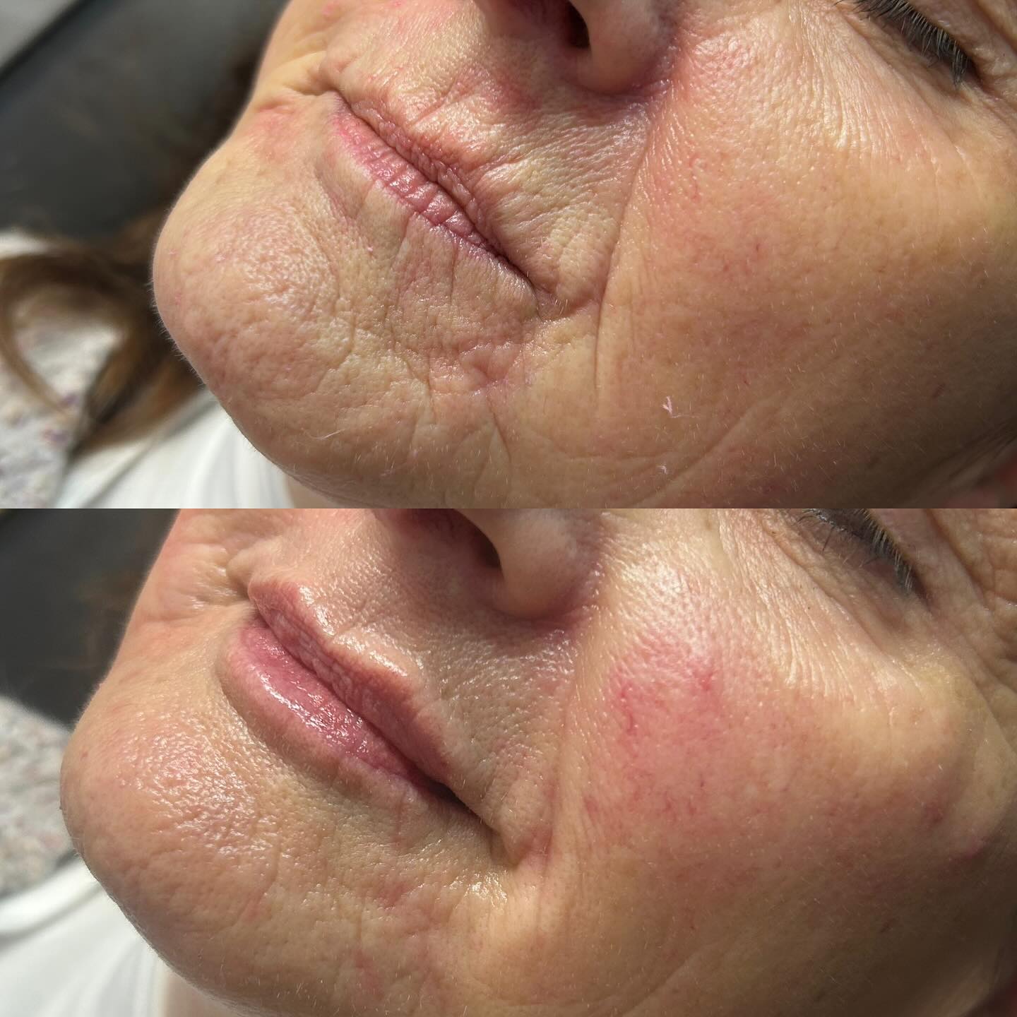  QT Injectables - Advanced Aesthetics-  Enquiries: qtinjectables1@hotmail.com  