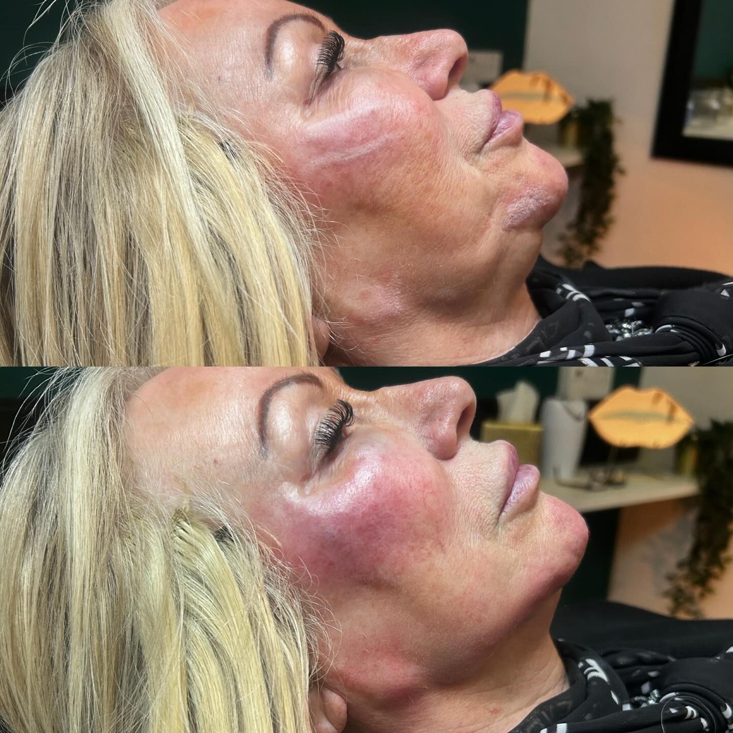  QT Injectables - Advanced Aesthetics-  Enquiries: qtinjectables1@hotmail.com  