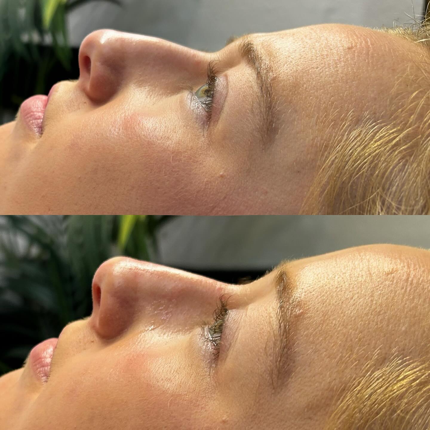  QT Injectables - Advanced Aesthetics-  Enquiries: qtinjectables1@hotmail.com  