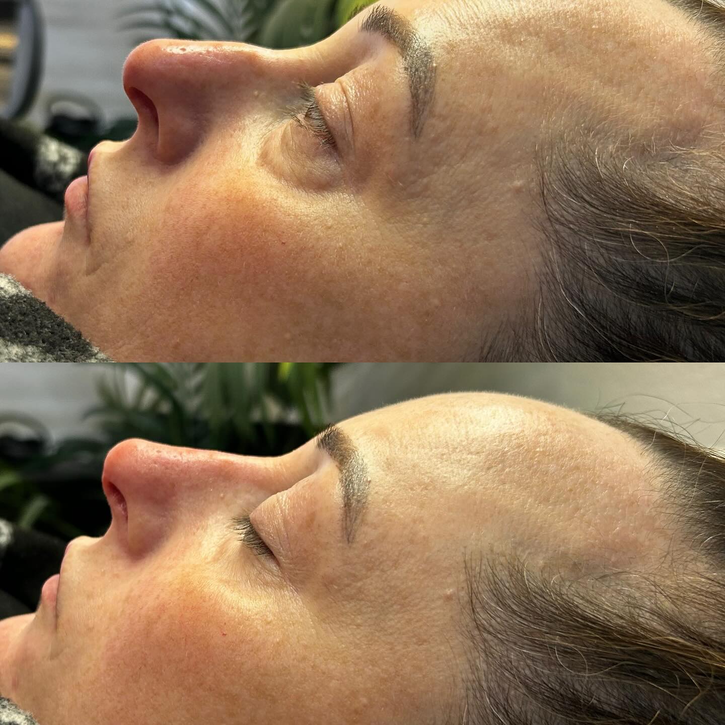  QT Injectables - Advanced Aesthetics -  Enquiries: qtinjectables1@hotmail.com  