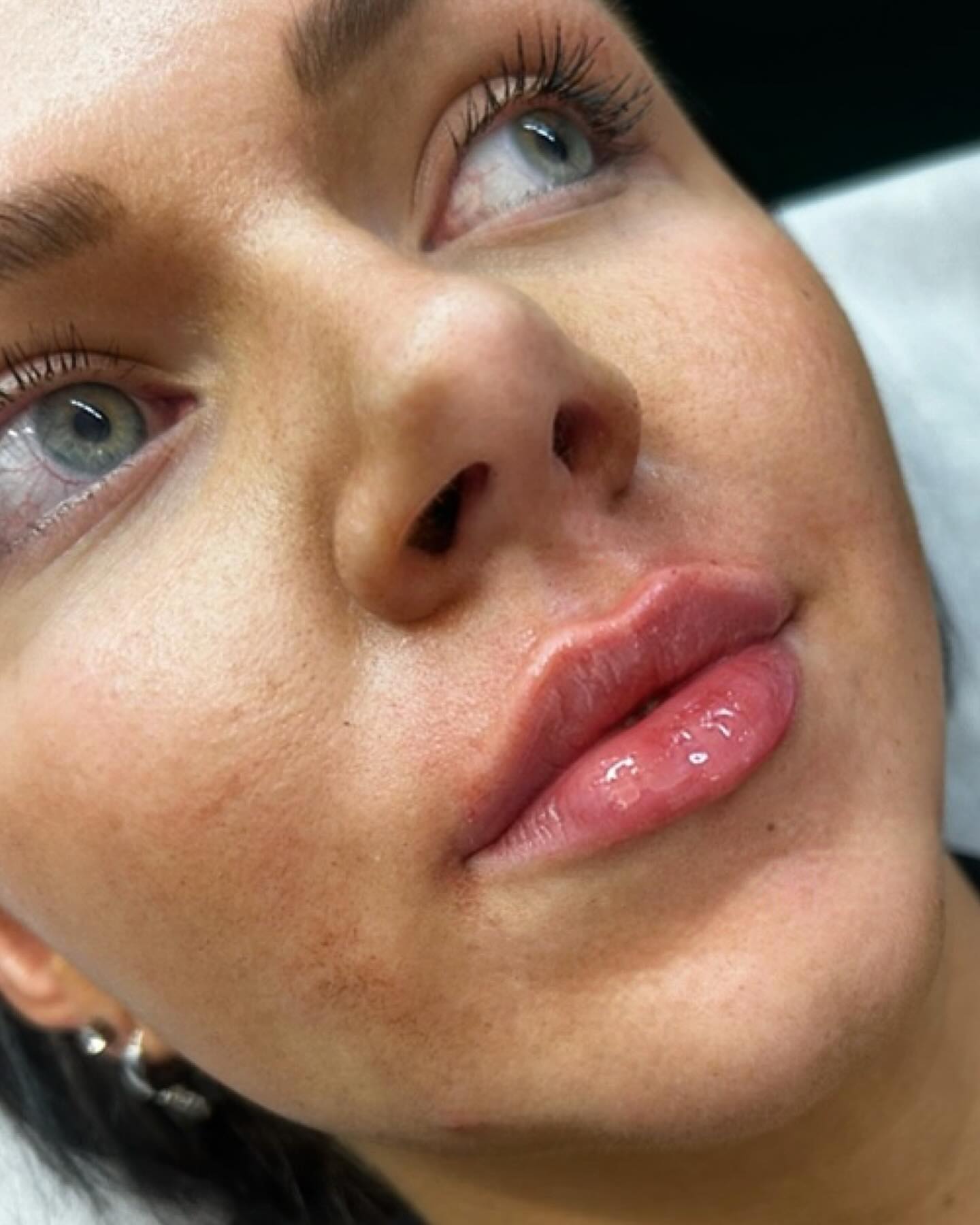  QT Injectables - Advanced Aesthetics-  Enquiries: qtinjectables1@hotmail.com  